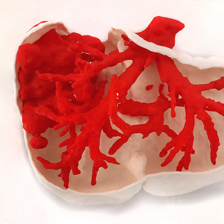 【3D列印應用】腫瘤切除術前規劃，手術加快1小時！